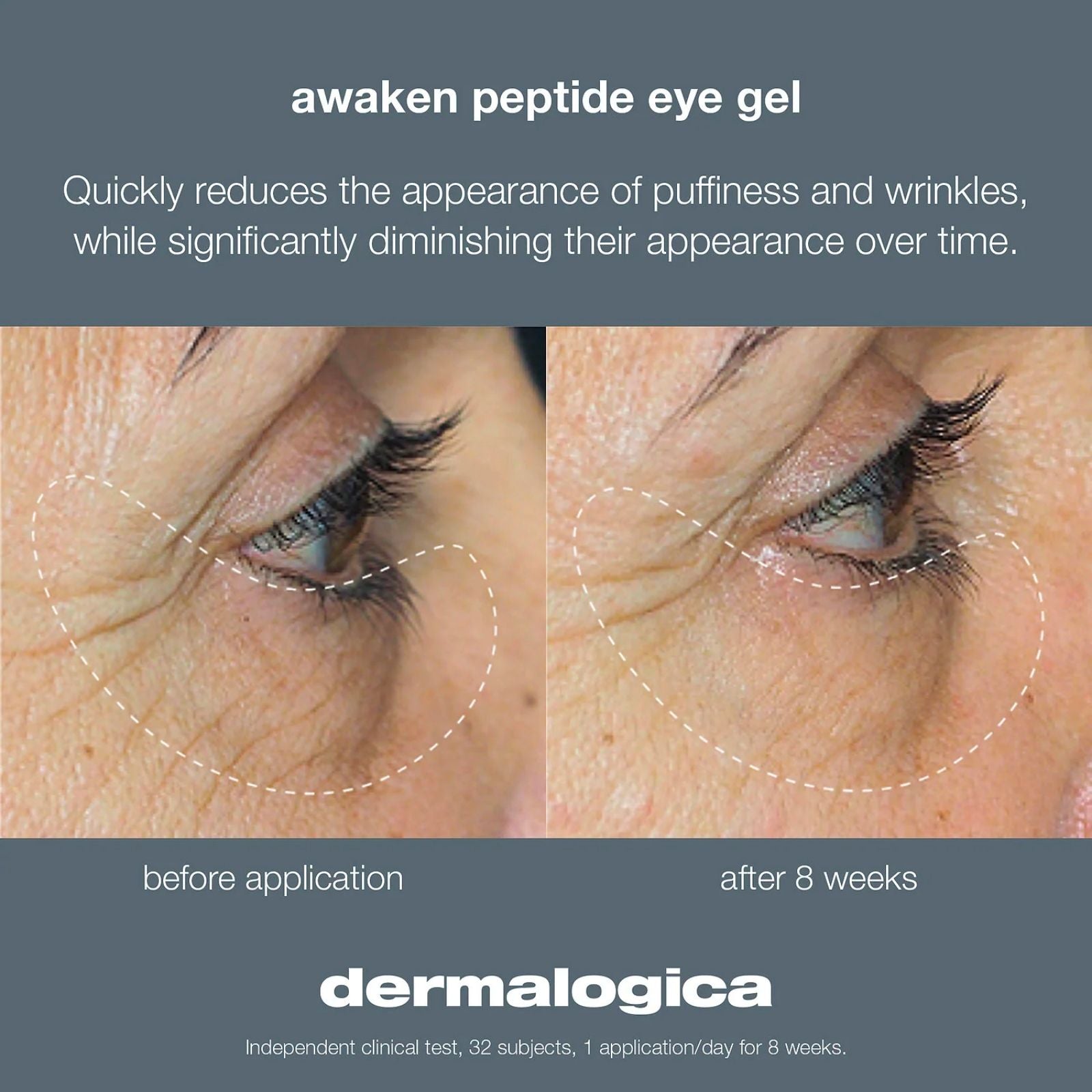 Dermalogica Dermalogica | Awaken Peptide Eye Gel | 15ml - SkinShop