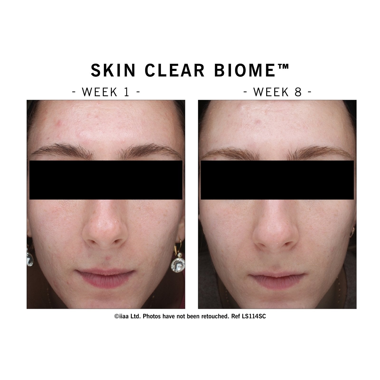 Advanced Nutrition Programme Skin Clear Biome 10 Day Discovery Pack - SkinShop